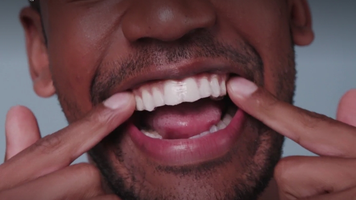 Professional Teeth Whitening Strips