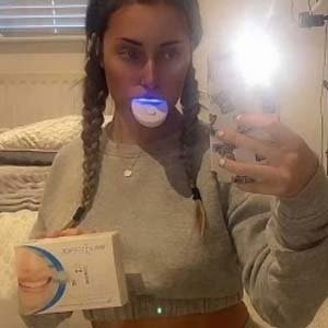 Teeth Whitening Kit Review - Molly