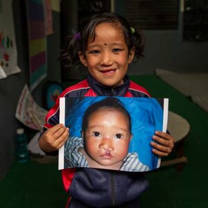 Smile-Train-Results-3.jpg